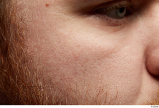  HD Face skin Michael Summers cheek face sin texture skin pores wrinkles 0003.jpg